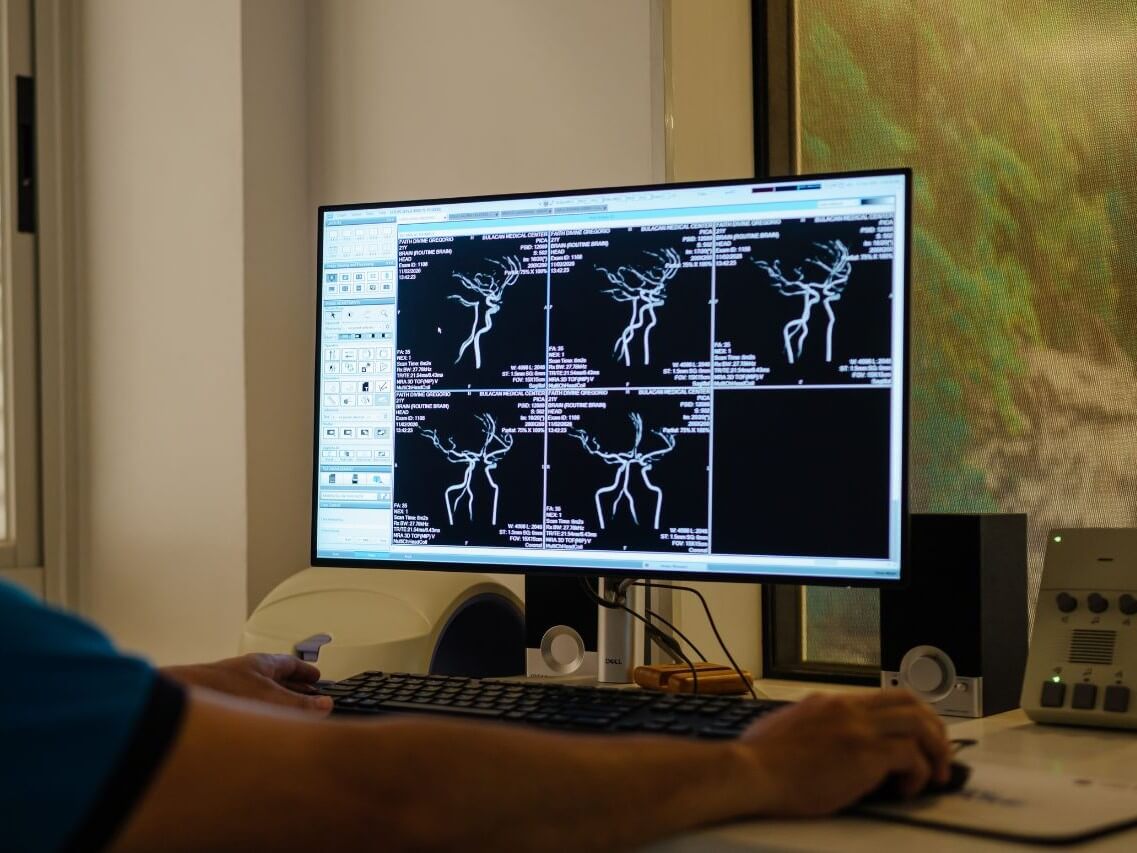 MRI scans | Contributed photo